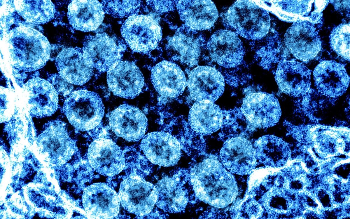 Covid-19 – Informação aos Associados | Encerramento dos serviços na sede e nos secretariados regionais do STE